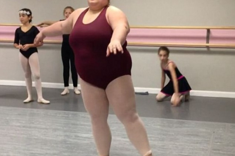Юные толстухи. Толстая балерина. Пышка балерина. Очень толстая балерина.