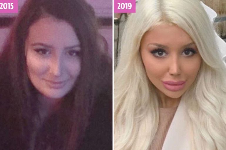 Swedish Barbie Wannabe Spends 17 000 A Year On Surgery To Look Like A Doll Armenian News